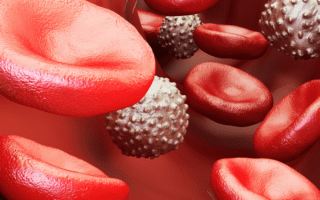 Cum luptăm împotriva anemiei: cauze și tratamente