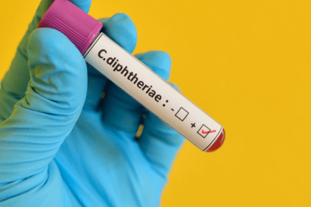 Ce este difteria și importanța prevenirii sale
